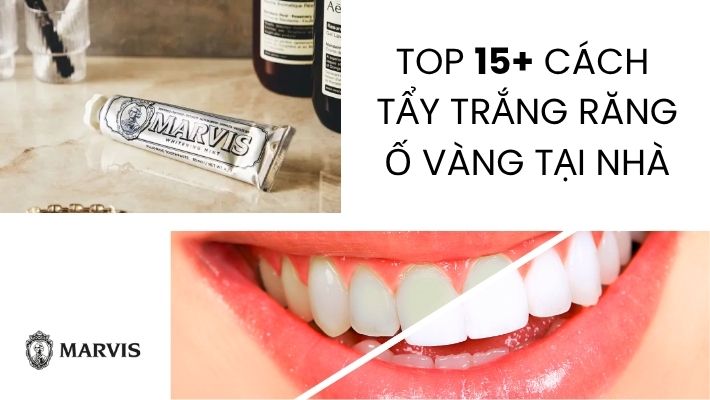 Cách tẩy trắng răng ố vàng tại nhà