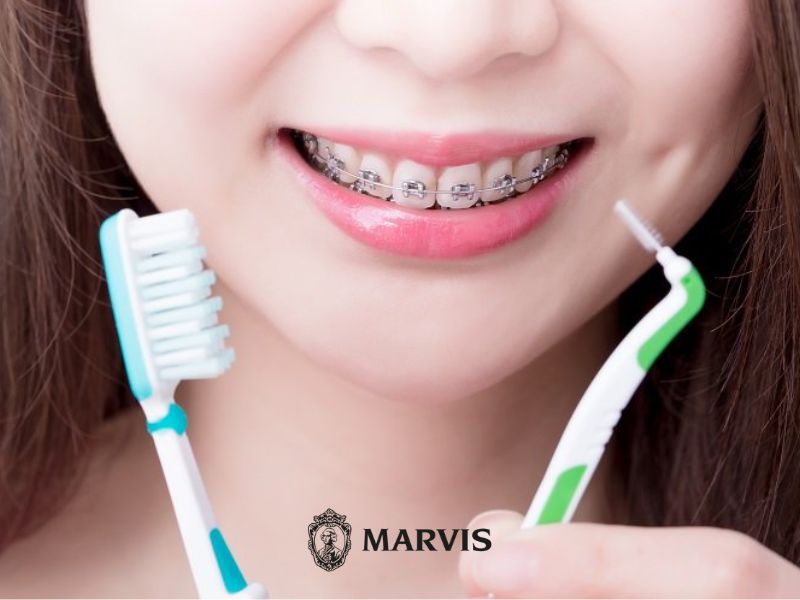 vệ sinh răng miệng khi niềng răng