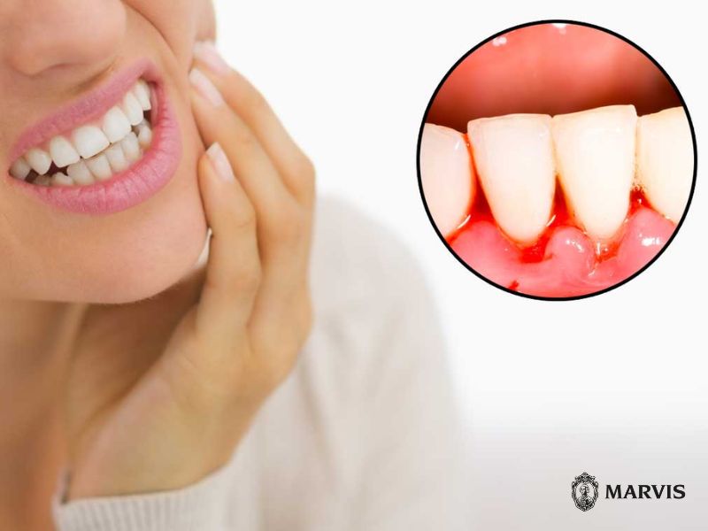 đánh răng bị chảy máu là bị gì