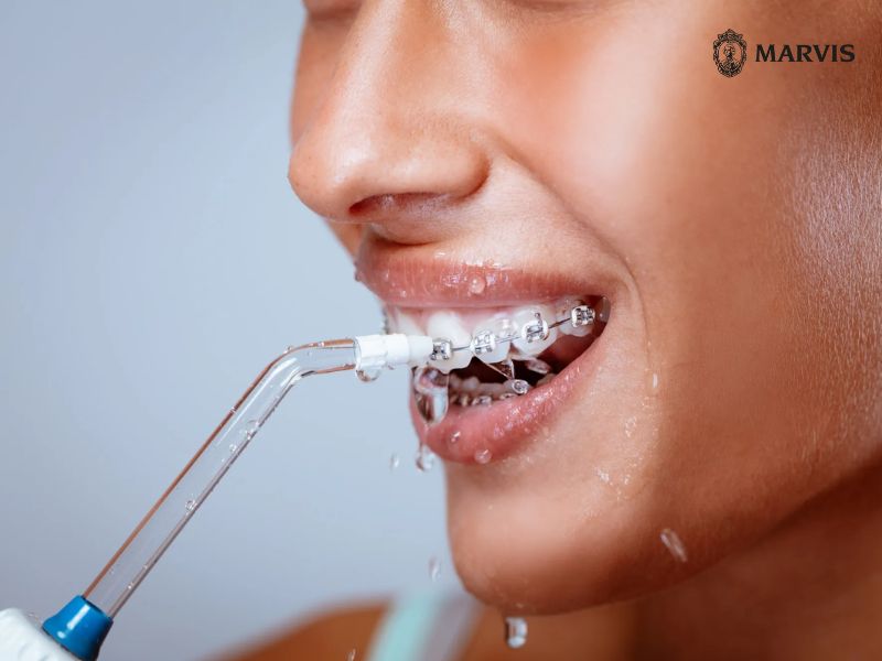 Hướng dẫn chi tiết cách vệ sinh răng niềng bằng tăm nước