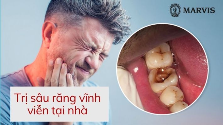 Trị sâu răng vĩnh viễn tại nhà